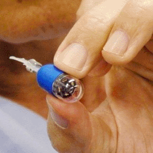 Imagen: La cápsula endoscópica controlada remotamente, Mermaid (Fotografía cortesía del Colegio Médico de Osaka). Imagen: La cápsula endoscópica controlada remotamente, Mermaid (Fotografía cortesía del Colegio Médico de Osaka).